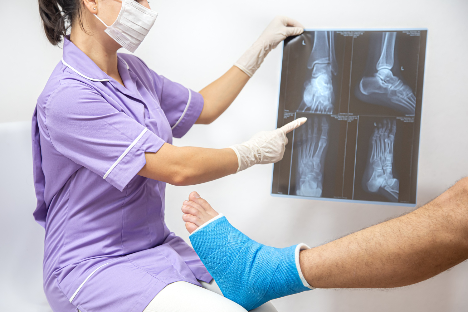 24/7 Emergency Fracture Treatment